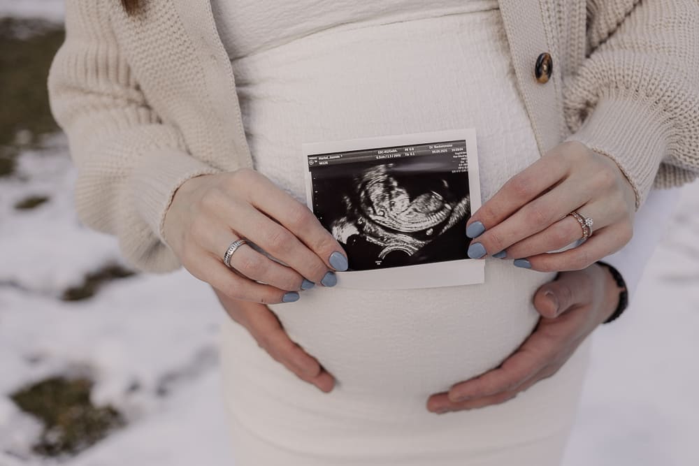Babybauch Fotoshooting bei Ansbach – Ultraschallbild wird liebevoll vor dem Bauch gehalten